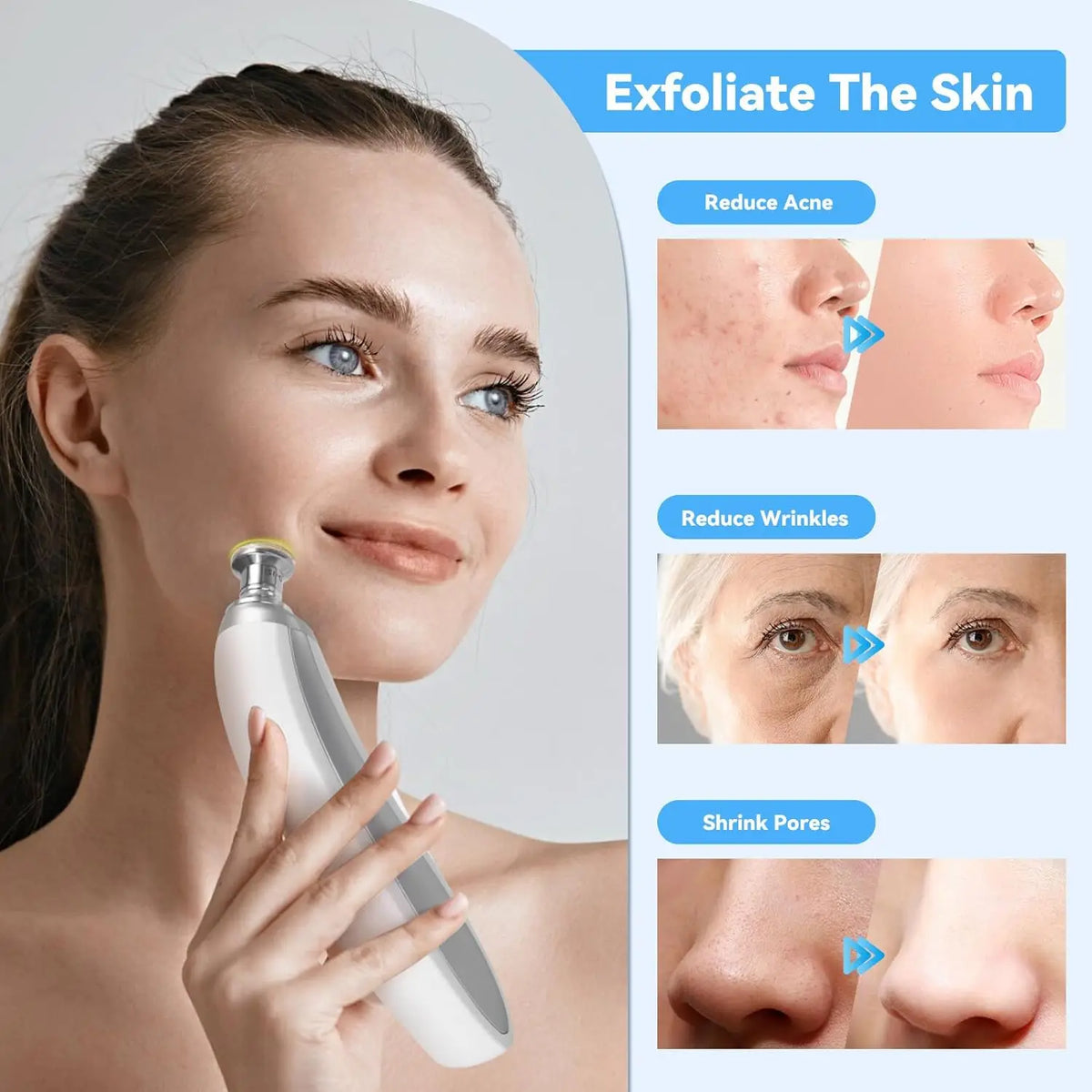 Diamond Microdermabrasion Machine, Portable Microdermabrasion Tool for Blackhead Removal, Facial Skin Care Device for Home Use